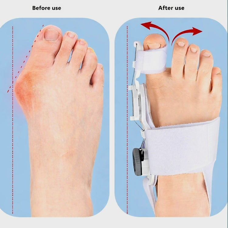 Adjustable Thumb Corrector